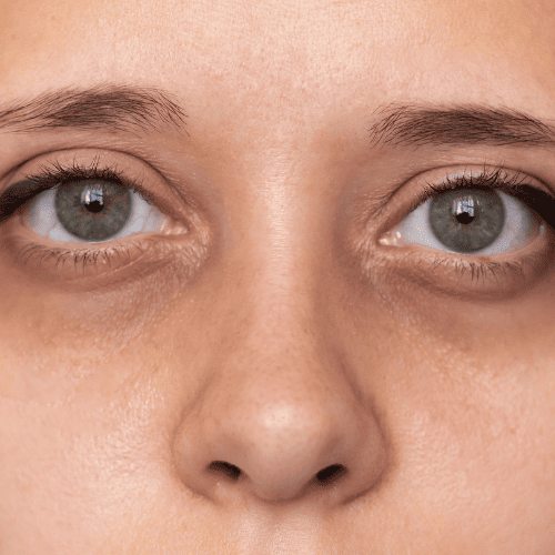 Tired and dull skin